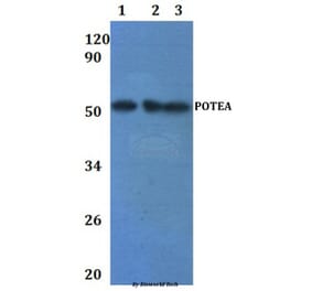 Anti-POTEA Antibody from Bioworld Technology (BS61241) - Antibodies.com