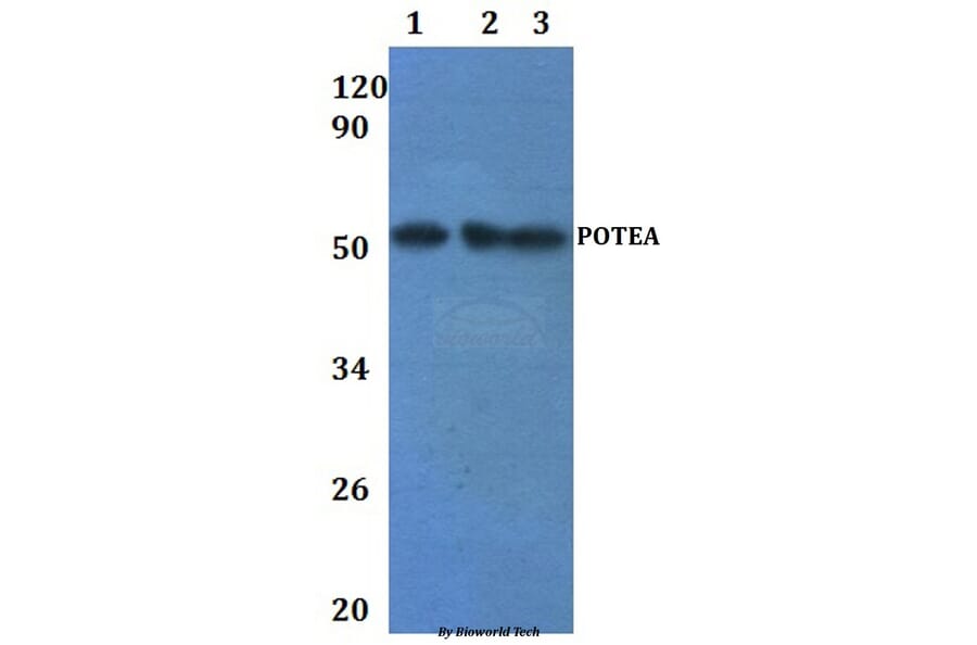 Anti-POTEA Antibody from Bioworld Technology (BS61241) - Antibodies.com