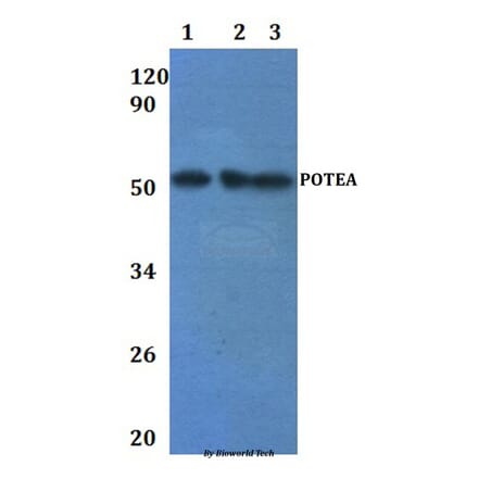 Anti-POTEA Antibody from Bioworld Technology (BS61241) - Antibodies.com