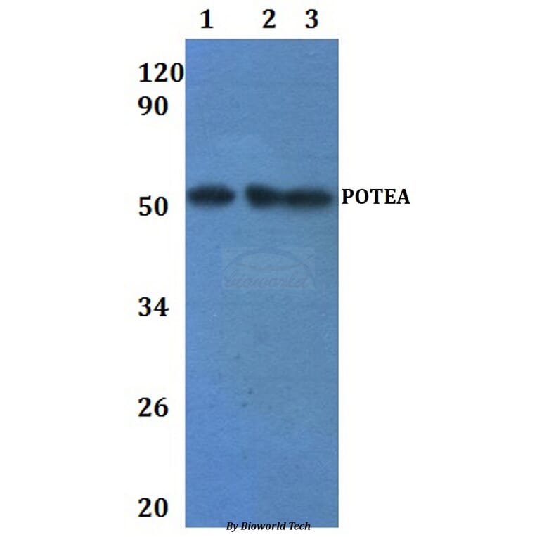 Anti-POTEA Antibody from Bioworld Technology (BS61241) - Antibodies.com