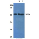 Anti-POTEA Antibody from Bioworld Technology (BS61241) - Antibodies.com