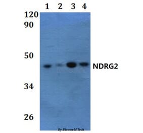 Anti-NDRG2 Antibody from Bioworld Technology (BS61243) - Antibodies.com