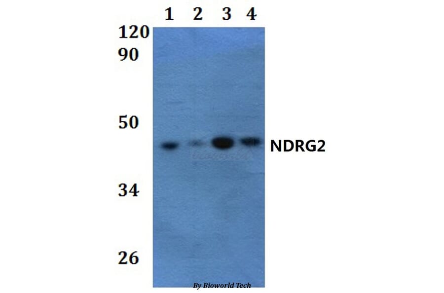 Anti-NDRG2 Antibody from Bioworld Technology (BS61243) - Antibodies.com