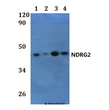 Anti-NDRG2 Antibody from Bioworld Technology (BS61243) - Antibodies.com