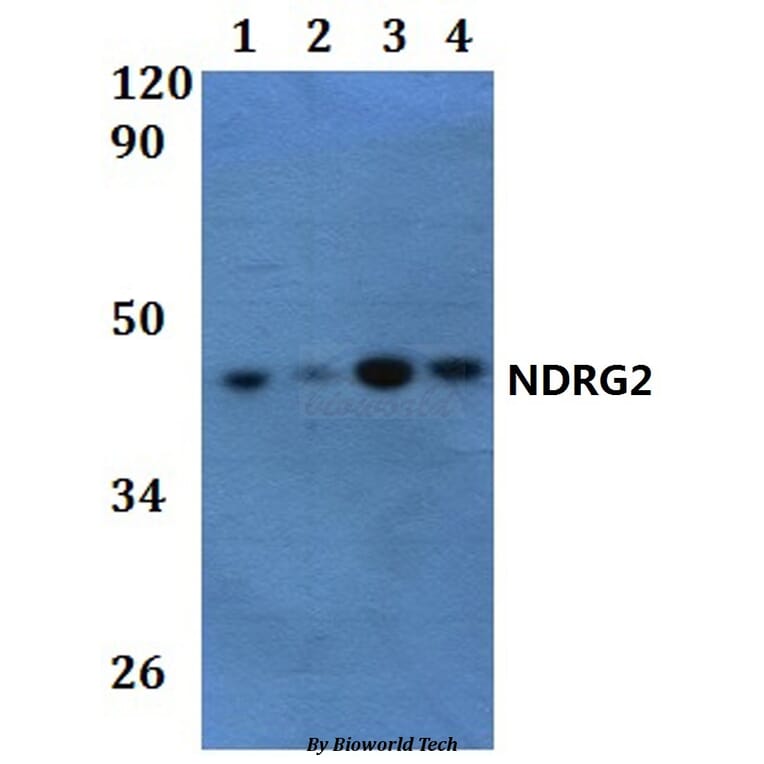 Anti-NDRG2 Antibody from Bioworld Technology (BS61243) - Antibodies.com