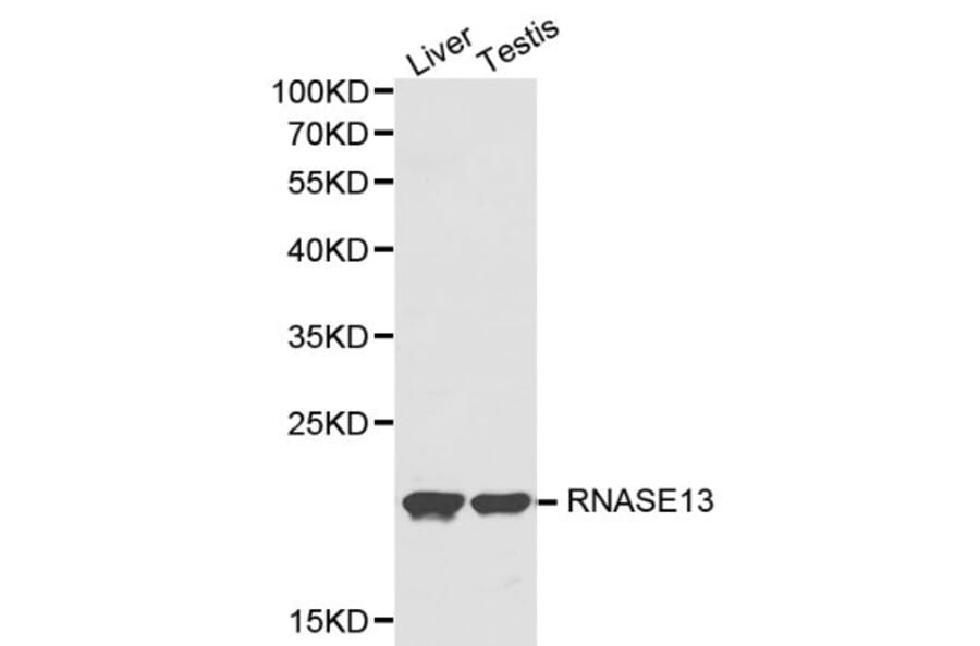 Anti-RNASE13 Antibody from Bioworld Technology (BS6125) - Antibodies.com
