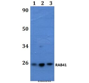 Anti-RAB41 Antibody from Bioworld Technology (BS61254) - Antibodies.com