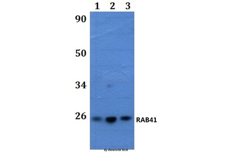 Anti-RAB41 Antibody from Bioworld Technology (BS61254) - Antibodies.com