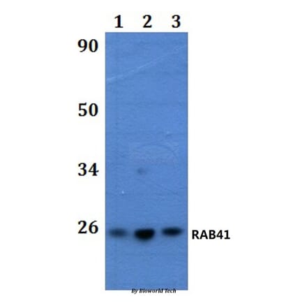 Anti-RAB41 Antibody from Bioworld Technology (BS61254) - Antibodies.com