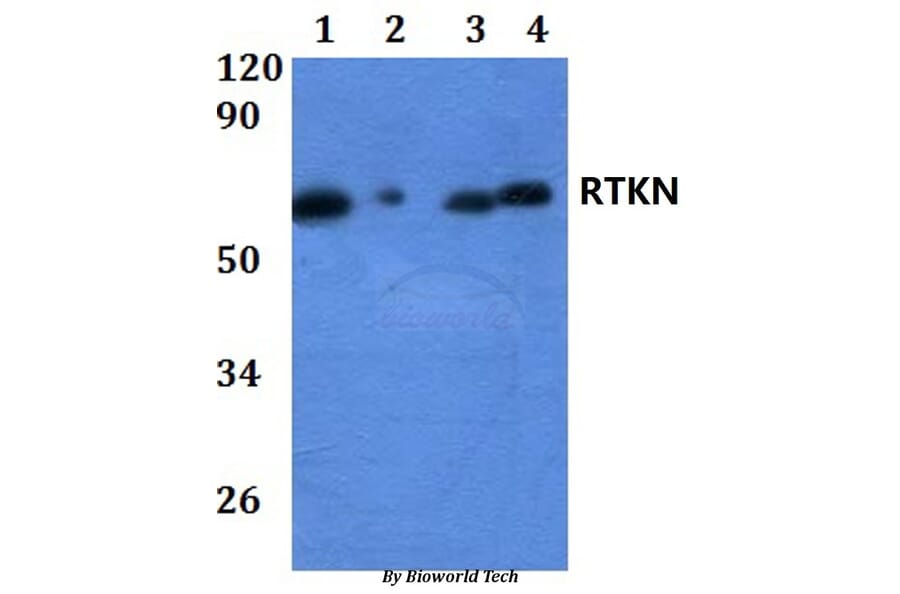 Anti-RTKN Antibody from Bioworld Technology (BS61257) - Antibodies.com