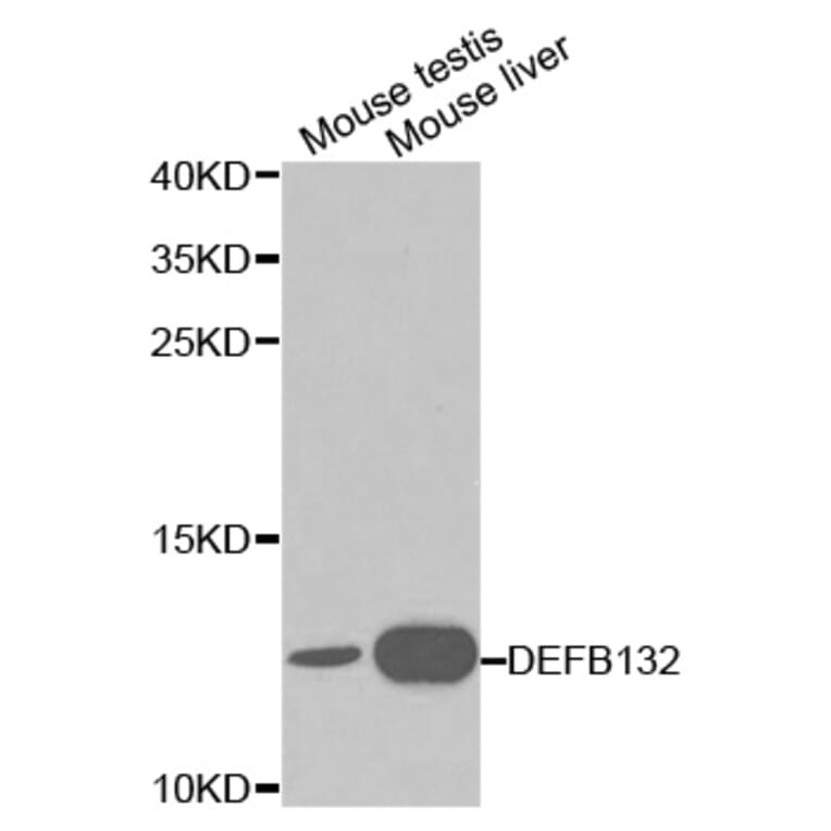 Anti-DEFB132 Antibody from Bioworld Technology (BS6126) - Antibodies.com