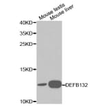Anti-DEFB132 Antibody from Bioworld Technology (BS6126) - Antibodies.com