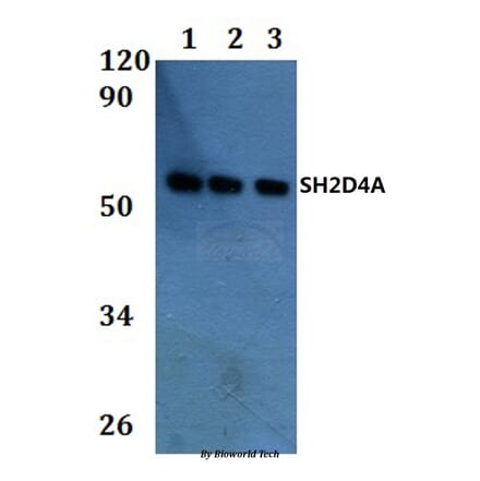 Anti-SH2D4A Antibody from Bioworld Technology (BS61270) - Antibodies.com