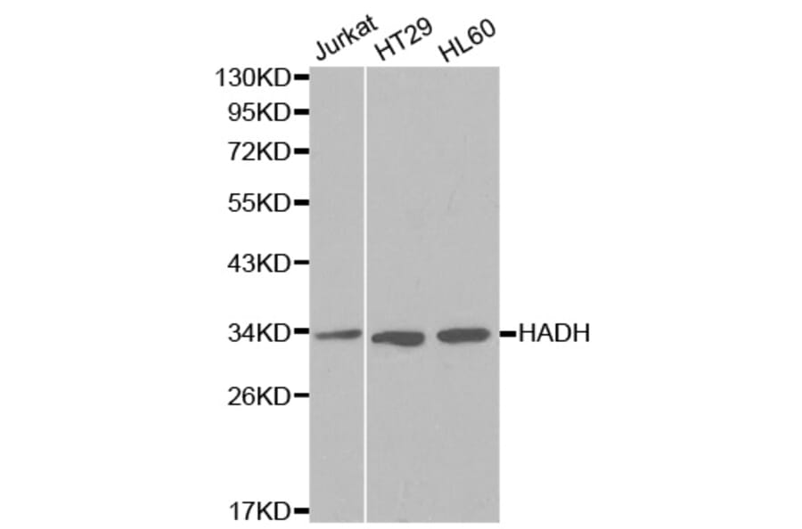 Anti-HADH Antibody from Bioworld Technology (BS6128) - Antibodies.com