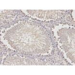 Anti-HADH Antibody from Bioworld Technology (BS6128) - Antibodies.com