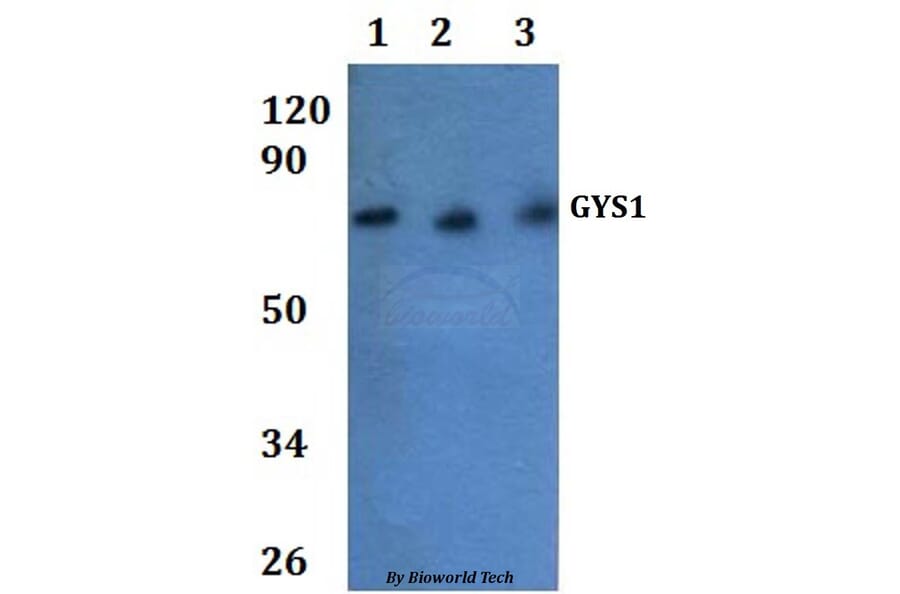 Anti-GYS1 Antibody from Bioworld Technology (BS61282) - Antibodies.com