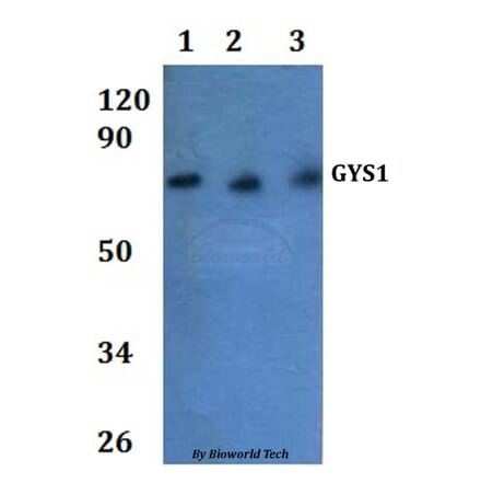 Anti-GYS1 Antibody from Bioworld Technology (BS61282) - Antibodies.com