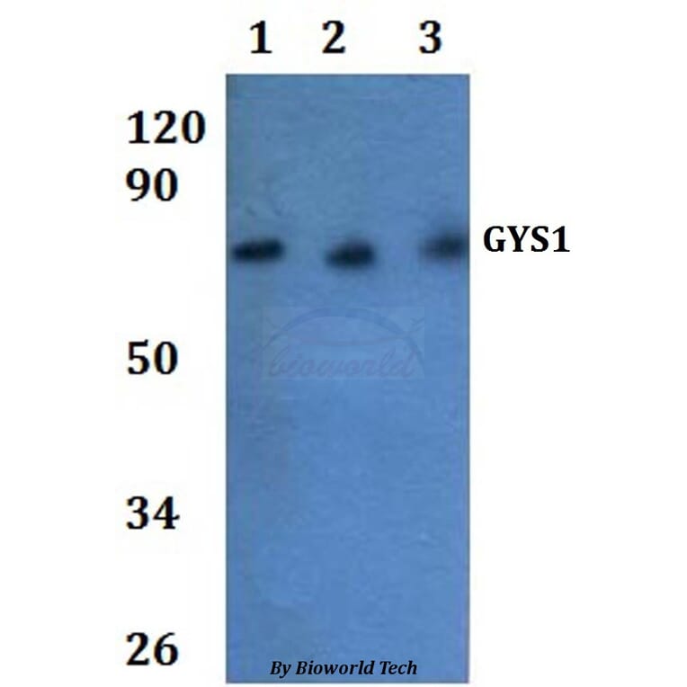 Anti-GYS1 Antibody from Bioworld Technology (BS61282) - Antibodies.com