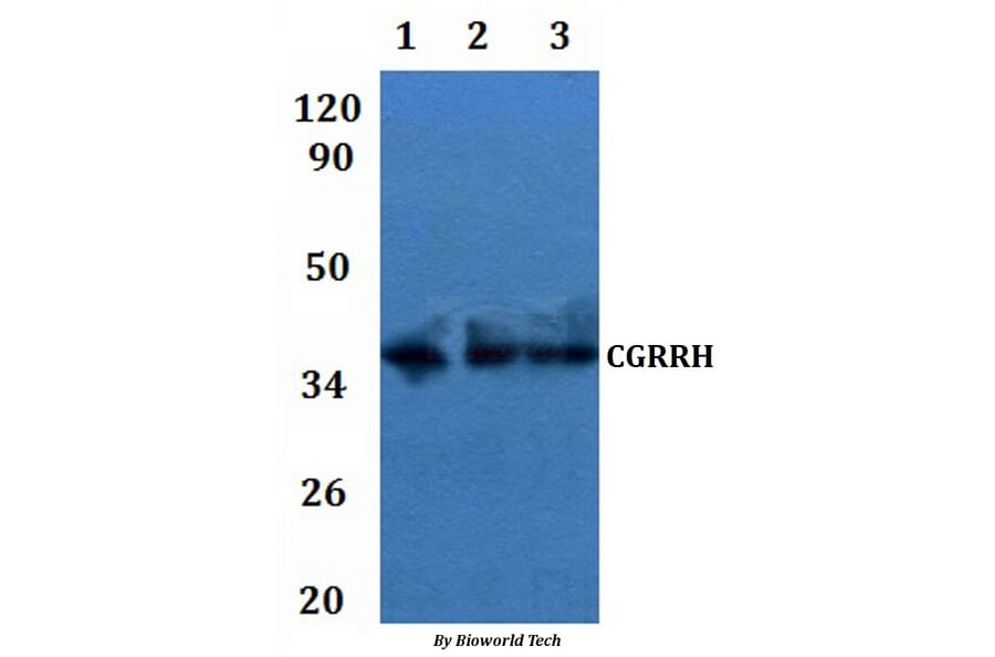 Anti-CGRRH Antibody from Bioworld Technology (BS61283) - Antibodies.com