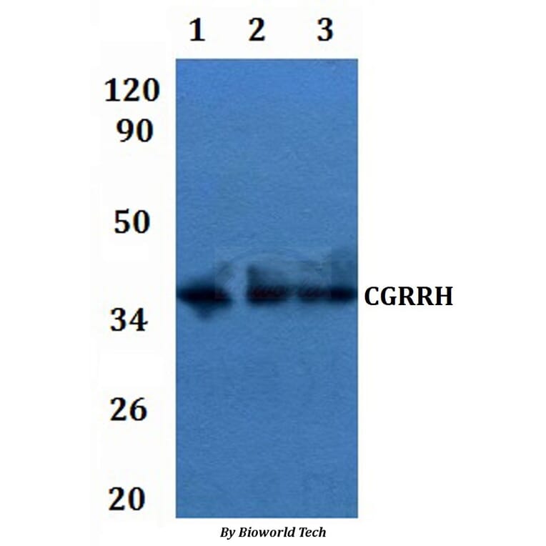 Anti-CGRRH Antibody from Bioworld Technology (BS61283) - Antibodies.com