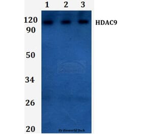 Anti-HDAC9 Antibody from Bioworld Technology (BS61285) - Antibodies.com