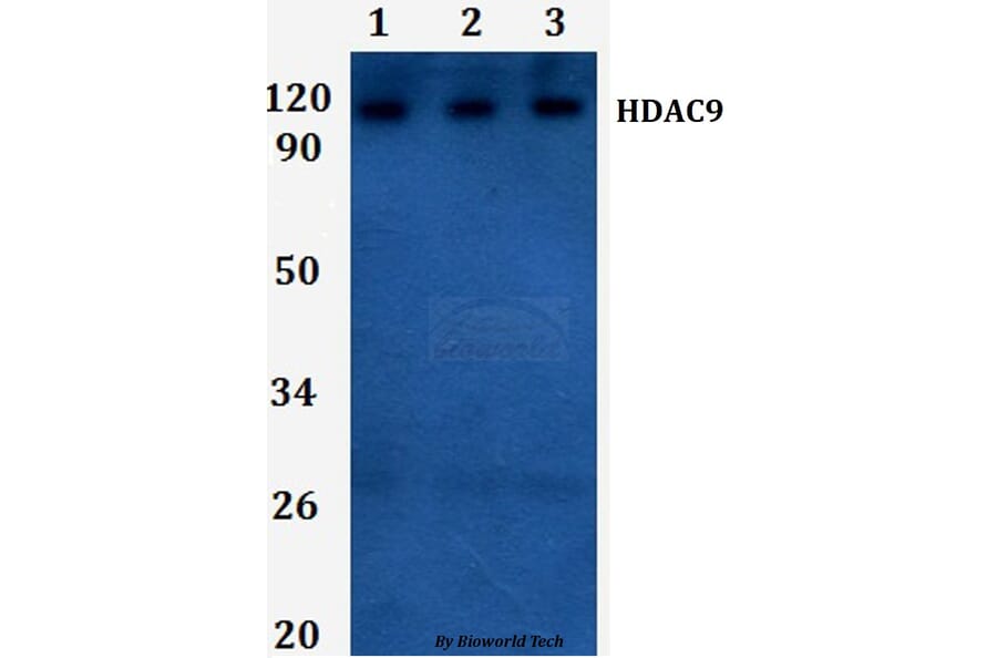 Anti-HDAC9 Antibody from Bioworld Technology (BS61285) - Antibodies.com