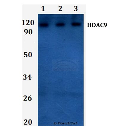 Anti-HDAC9 Antibody from Bioworld Technology (BS61285) - Antibodies.com