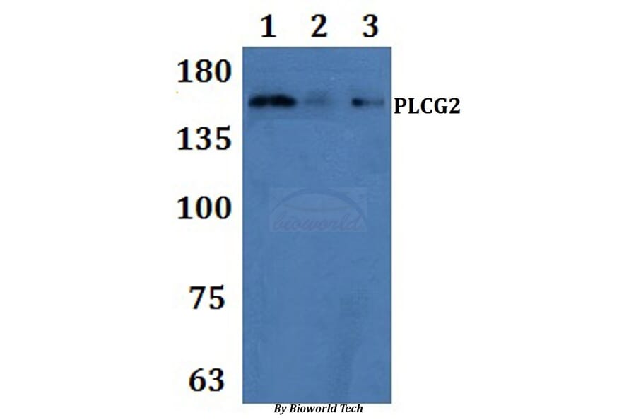 Anti-PLC γ2 Antibody from Bioworld Technology (BS61288) - Antibodies.com