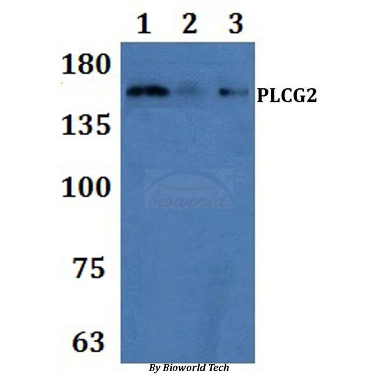 Anti-PLC γ2 Antibody from Bioworld Technology (BS61288) - Antibodies.com
