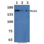 Anti-PLC γ2 Antibody from Bioworld Technology (BS61288) - Antibodies.com