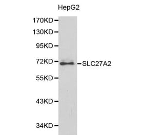 Anti-SLC27A2 Antibody from Bioworld Technology (BS6129) - Antibodies.com
