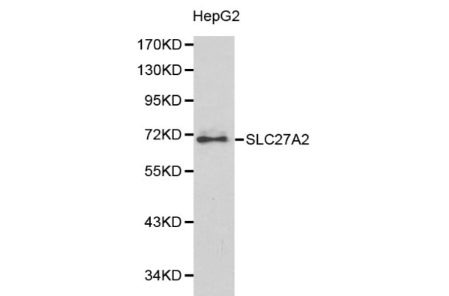 Anti-SLC27A2 Antibody from Bioworld Technology (BS6129) - Antibodies.com