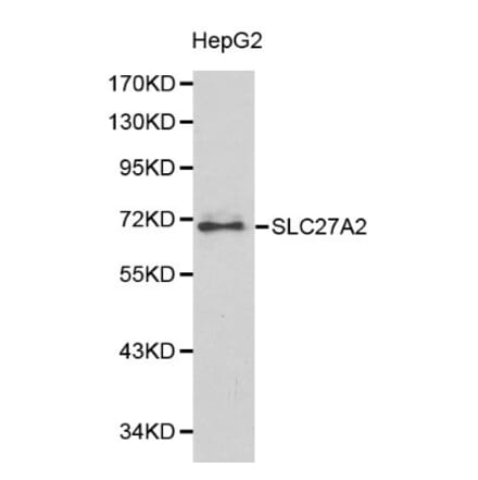 Anti-SLC27A2 Antibody from Bioworld Technology (BS6129) - Antibodies.com