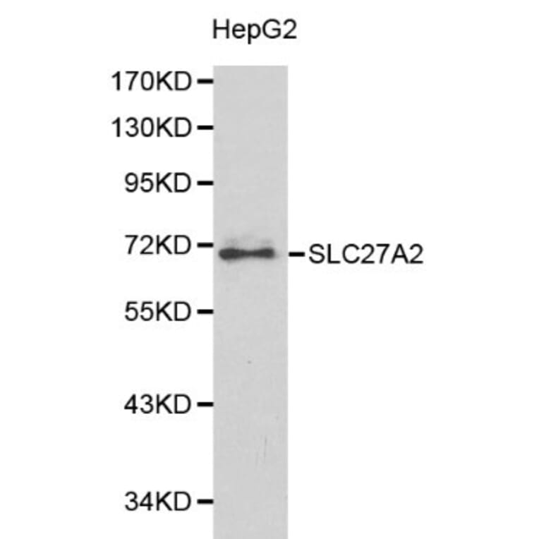 Anti-SLC27A2 Antibody from Bioworld Technology (BS6129) - Antibodies.com