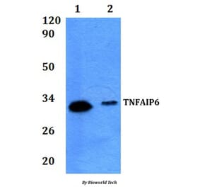 Anti-TNFAIP6 Antibody from Bioworld Technology (BS61291) - Antibodies.com