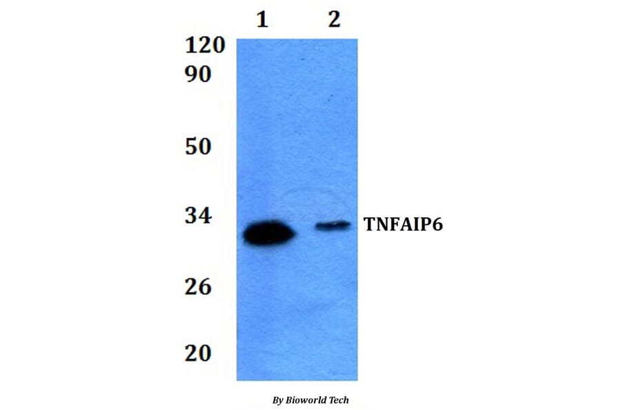 Anti-TNFAIP6 Antibody from Bioworld Technology (BS61291) - Antibodies.com