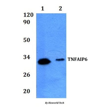 Anti-TNFAIP6 Antibody from Bioworld Technology (BS61291) - Antibodies.com