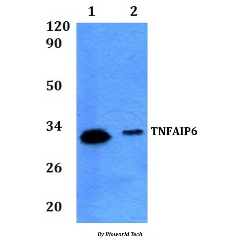 Anti-TNFAIP6 Antibody from Bioworld Technology (BS61291) - Antibodies.com