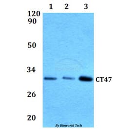 Anti-CT47 Antibody from Bioworld Technology (BS61293) - Antibodies.com