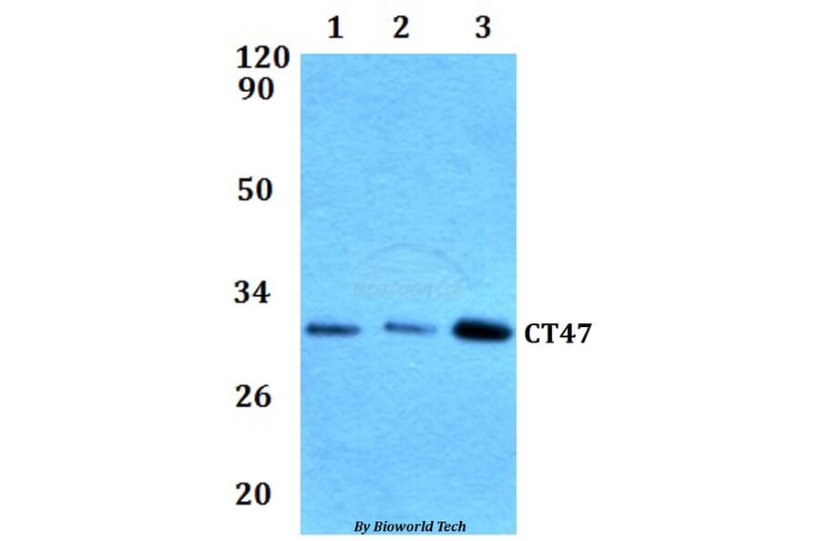 Anti-CT47 Antibody from Bioworld Technology (BS61293) - Antibodies.com