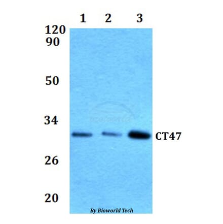 Anti-CT47 Antibody from Bioworld Technology (BS61293) - Antibodies.com
