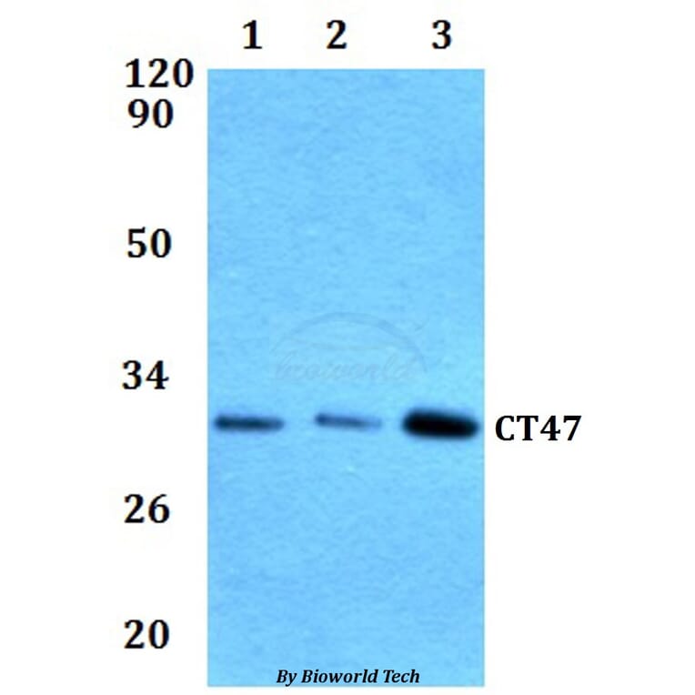 Anti-CT47 Antibody from Bioworld Technology (BS61293) - Antibodies.com