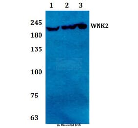 Anti-WNK2 Antibody from Bioworld Technology (BS61294) - Antibodies.com