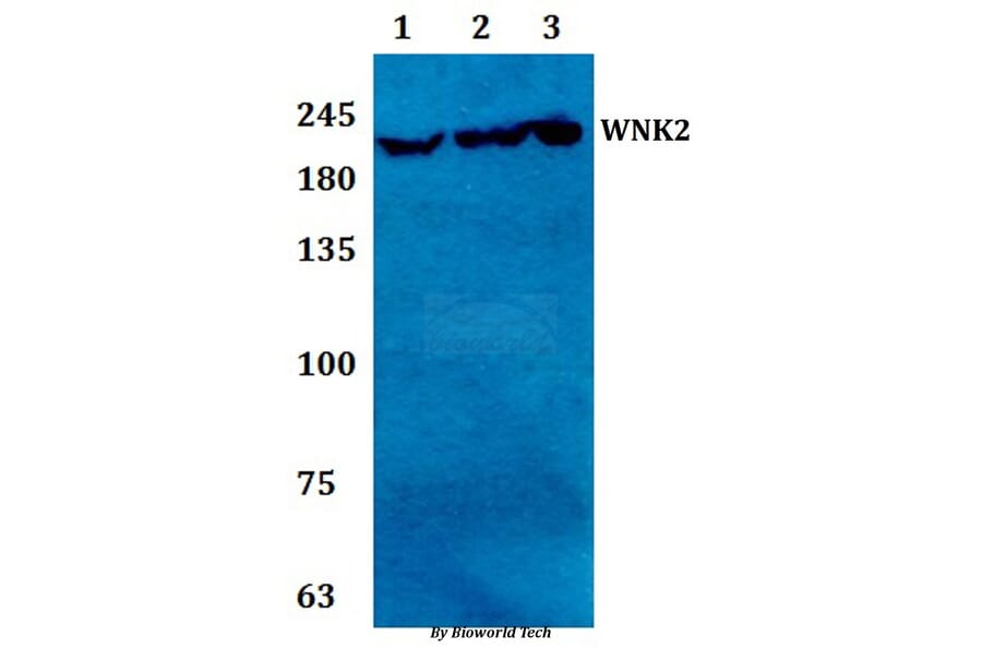 Anti-WNK2 Antibody from Bioworld Technology (BS61294) - Antibodies.com