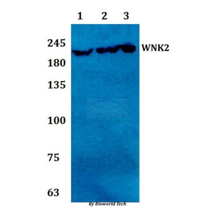 Anti-WNK2 Antibody from Bioworld Technology (BS61294) - Antibodies.com