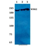 Anti-WNK2 Antibody from Bioworld Technology (BS61294) - Antibodies.com