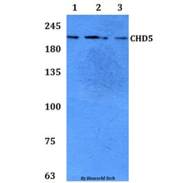 Anti-CHD5 Antibody from Bioworld Technology (BS61302) - Antibodies.com
