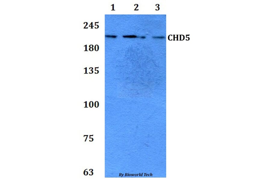 Anti-CHD5 Antibody from Bioworld Technology (BS61302) - Antibodies.com