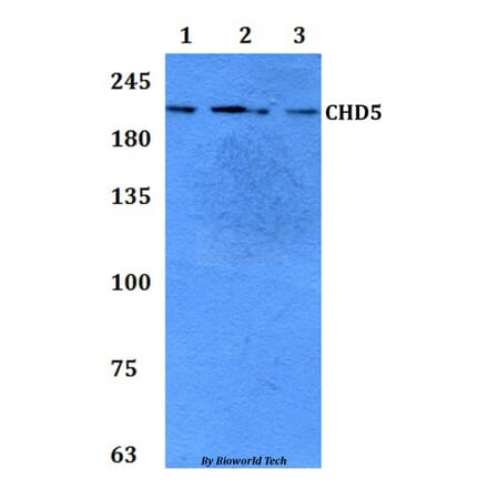 Anti-CHD5 Antibody from Bioworld Technology (BS61302) - Antibodies.com
