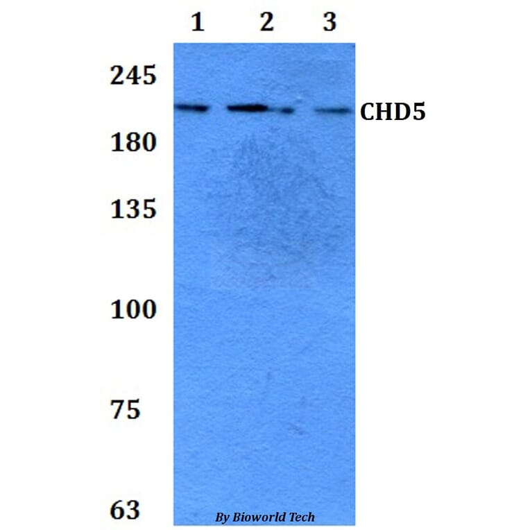Anti-CHD5 Antibody from Bioworld Technology (BS61302) - Antibodies.com